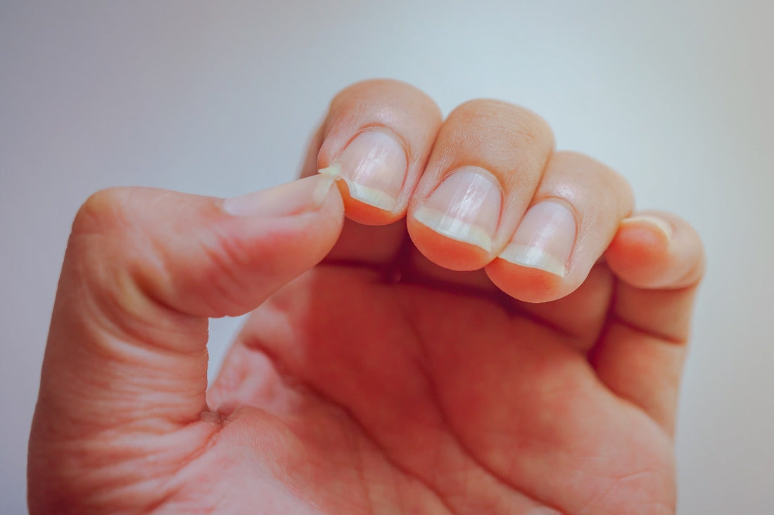 Uñas fuertes desde adentro: descubre el secreto con Finura Comprimidos
